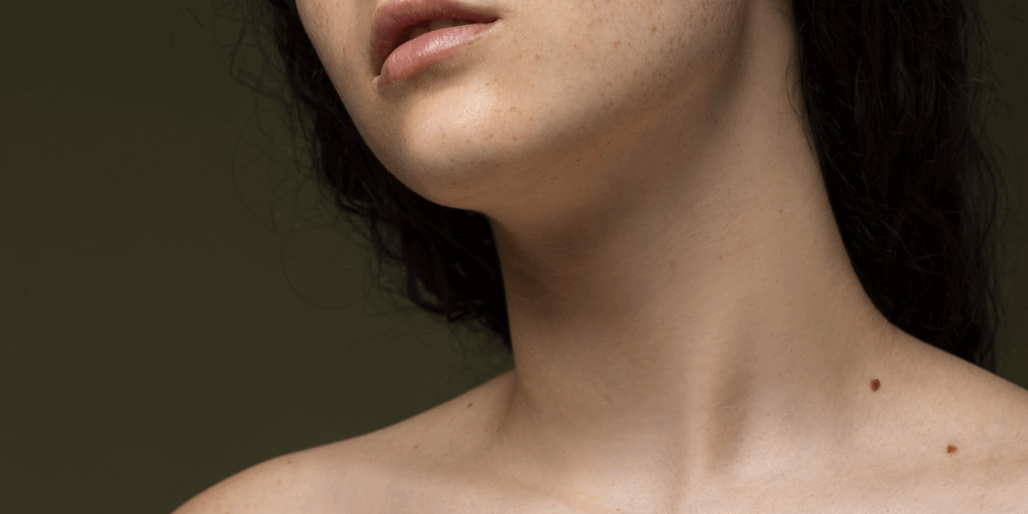 Pigmentstoerungen.png Nahaufnahme des Halses und Kinns einer Person mit leicht sichtbaren Sommersprossen und natürlichen Hauttönen.